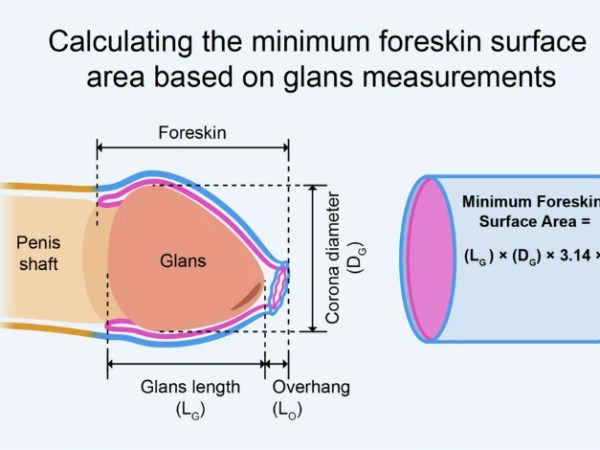 Neue Studie zur Anatomie der Vorhaut veröffentlicht